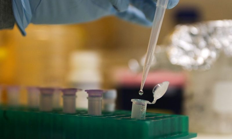 Sangamo Therapeutics stock drops 24% on results of cutting-edge gene-editing trial