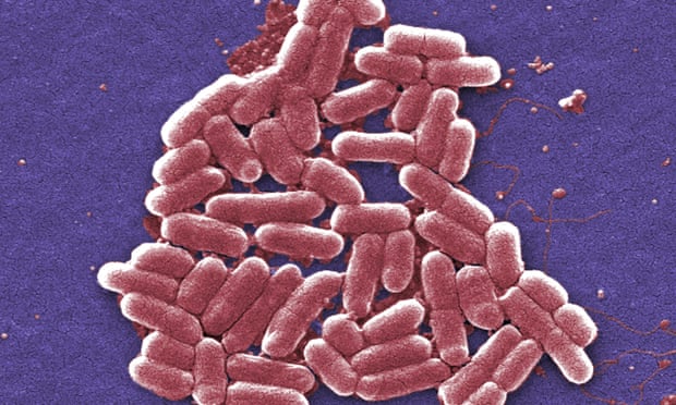 Two children from same family die after contracting E coli