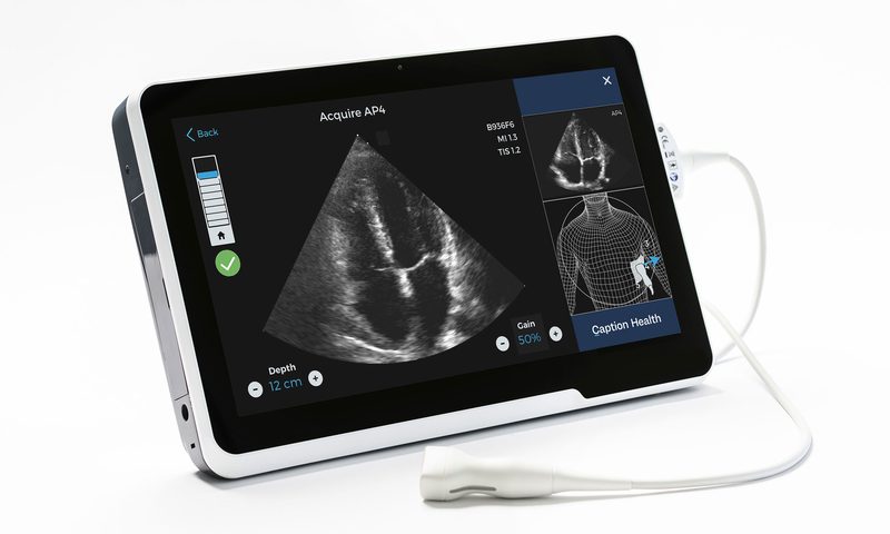 FDA approves AI that guides untrained clinicians in capturing high-quality cardiac ultrasounds