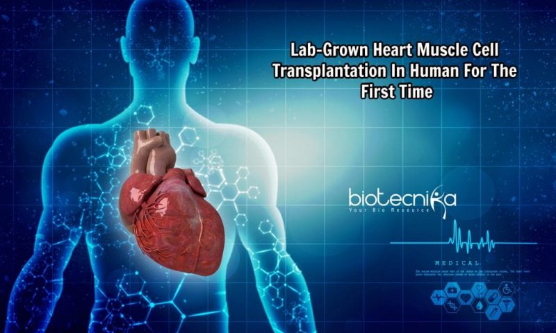 For The First Time Researchers Transplant Lab-Grown Muscle Cells Into Human