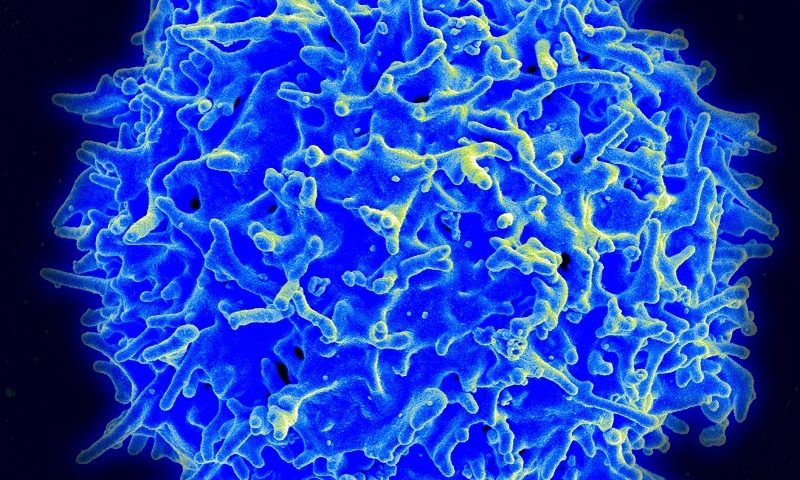 Sonoma Bio debuts with $40M to push Treg treatments for autoimmune, neuro diseases