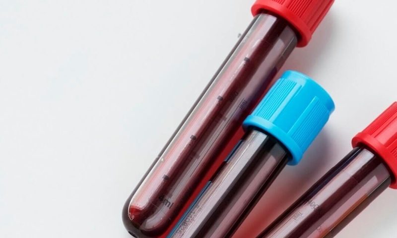 Grail kicks off its first study to provide doctors with real-world results from its multi-cancer blood test