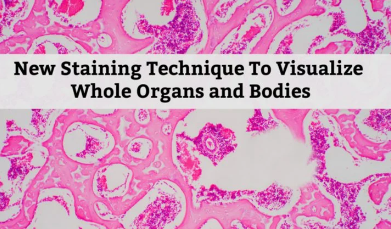 New Staining Technique To Visualize Whole Organs & Bodies