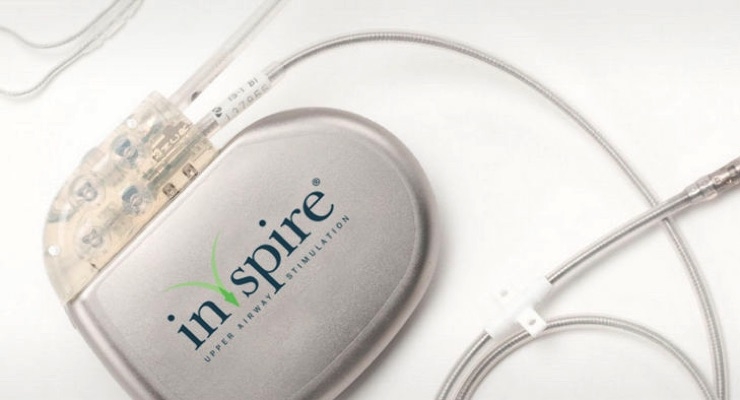 Inspire Medical Systems, Inc. Announces Medicare Policy Release Date of Local Coverage Determination for Sole Remaining Region