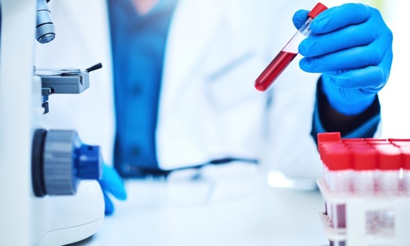 Foundation Medicine acquires liquid biopsy developer Lexent Bio