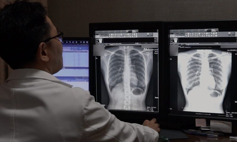 GE Healthcare rolls out new AI-powered chest X-ray suite