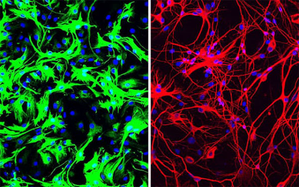 One-and-done gene therapy wipes out Parkinson’s symptoms in mouse models