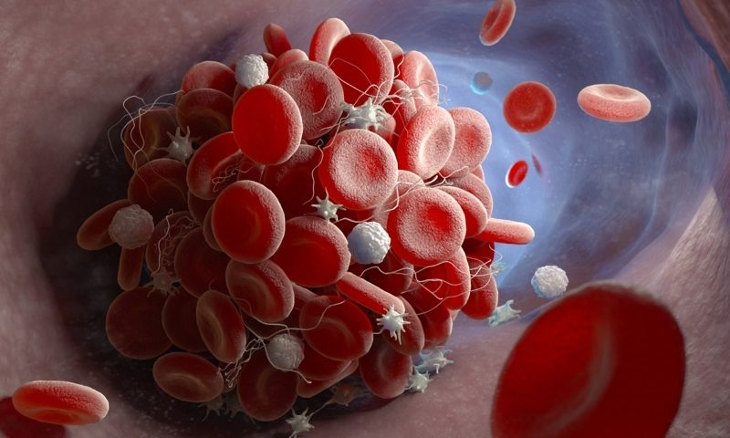 Preventing heart attacks by changing how platelets respond to blood flow stress