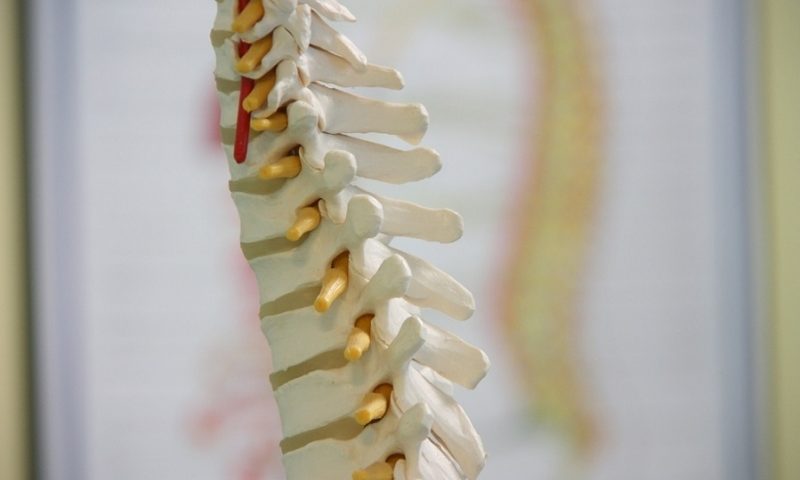 Medtronic to acquire Medicrea, maker of patient-specific, 3D-printed spine implants