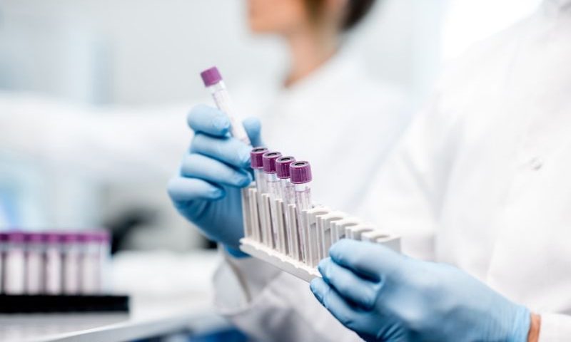 FDA ranks the performance of 58 molecular coronavirus tests from major developers
