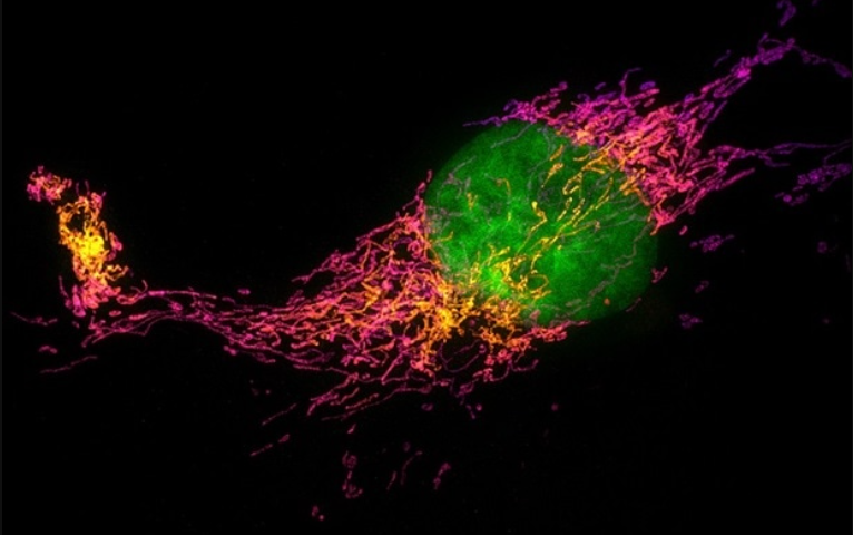 Super-resolution images of functioning and pathologically altered nerve cells