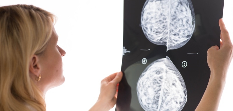 MGH breast cancer researchers use AI to spot new details in mammograms