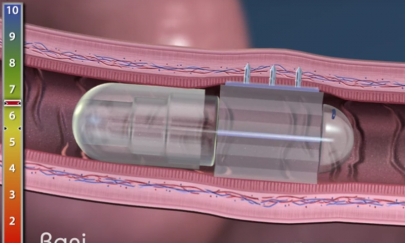 Rani Therapeutics nets $69M to transform injections into its easy-to-swallow ‘robotic pill’