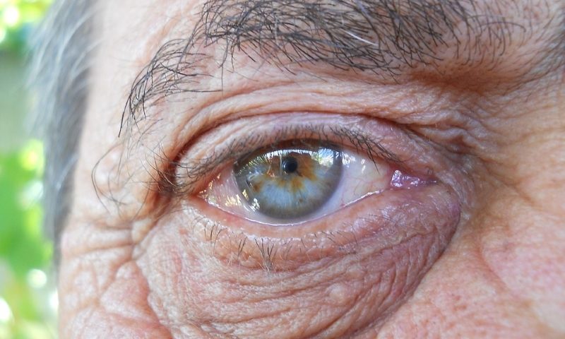 Reversing vision loss by turning back the aging clock