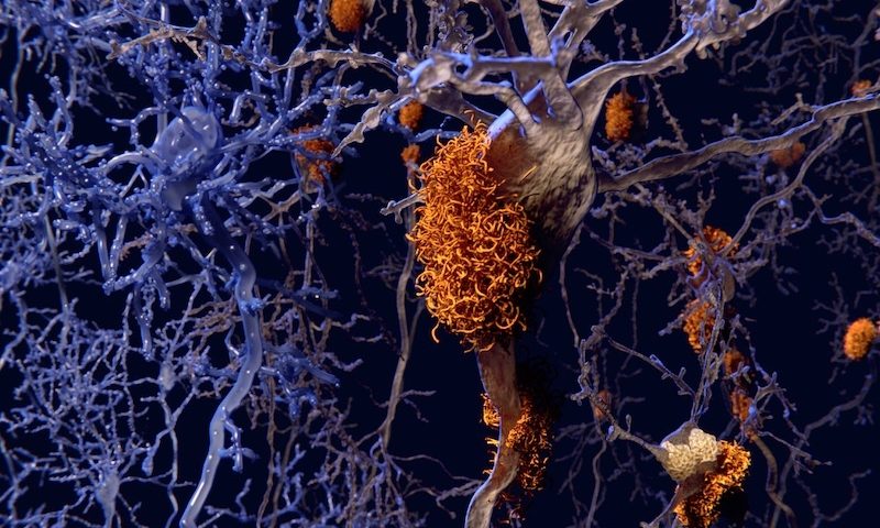 Alector, Annexon, Athira on what an aducanumab approval could mean for Alzheimer’s R&D
