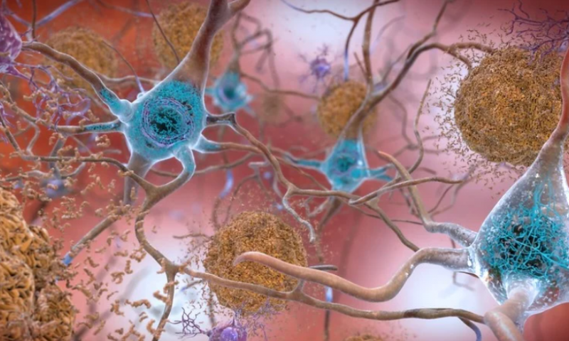A safer Alzheimer’s drug than Biogen’s aducanumab? Denali-WashU drug shows better profile in mice