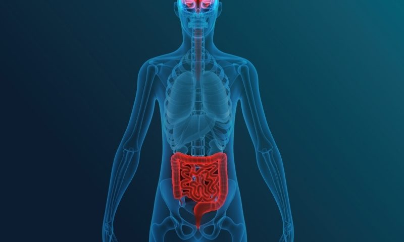 MS study points to the gut microbiome as a potential source of the disease