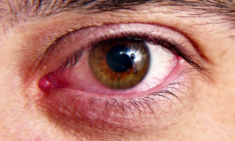 Adverum shares halved after trial patient goes blind in one eye after experimental gene therapy