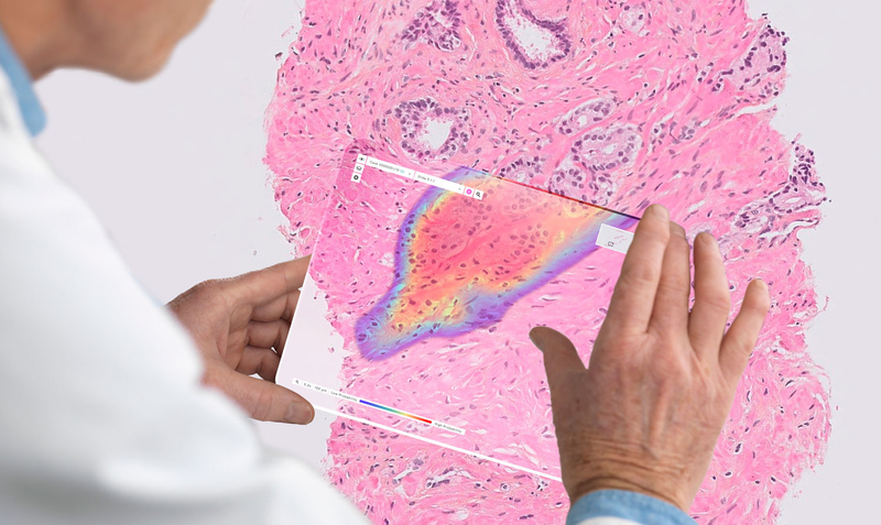 Ibex wins European approval for breast cancer-spotting AI pathology tool