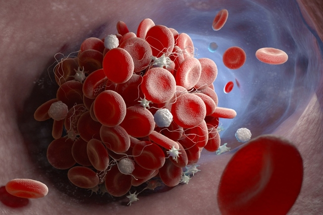 Hemab raises $55M to target multiple rare bleeding indications