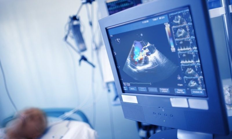Ultromics racks up $33M to drive its cardiac ultrasound AI software