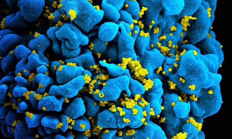 J&J’s HIV vaccine fails phase 2b, extending long wait for an effective jab