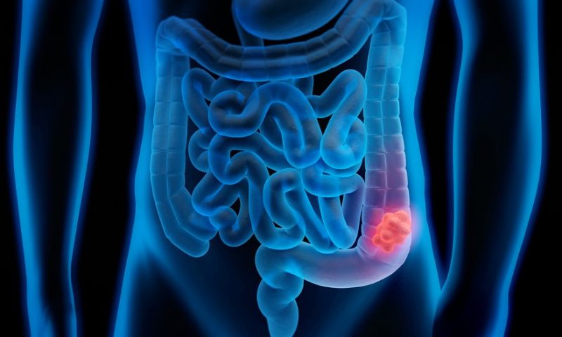 ESMO: Mirati pulls away from Amgen in colorectal cancer with rival KRAS drug