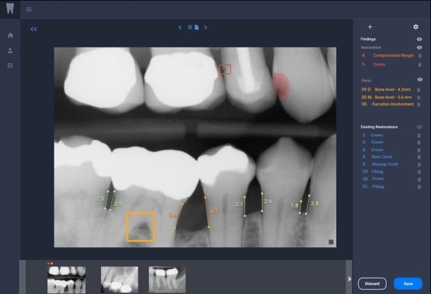 Overjet mints $27M to bring X-ray AI to more dental clinics