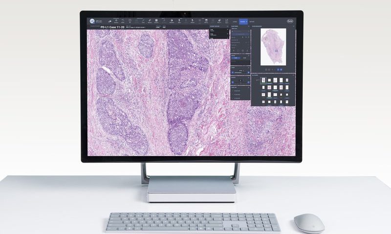 Roche welcomes PathAI into its open digital pathology initiative