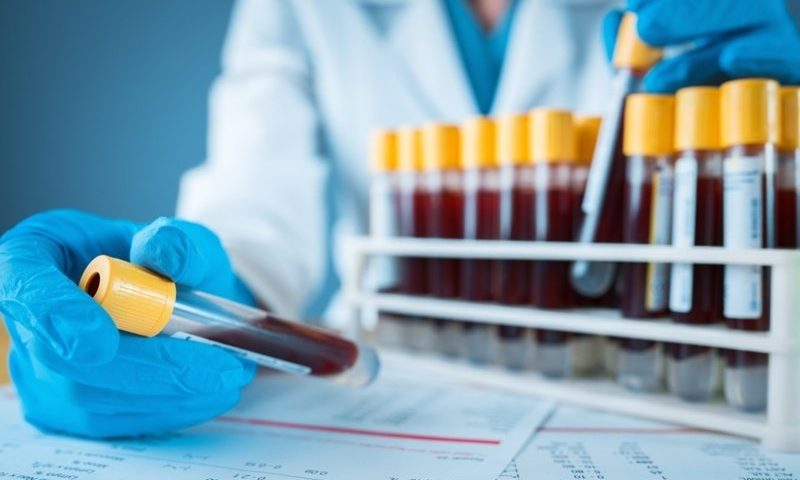 FDA unlocks faster clearances for future hepatitis C diagnostics