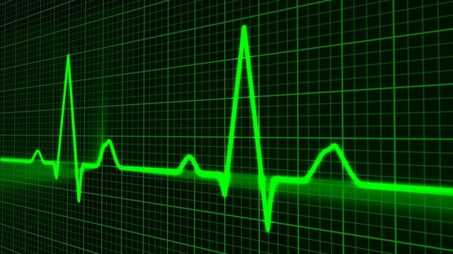 FDA clears heart mapping system that hunts down arrhythmias using only a 12-lead ECG