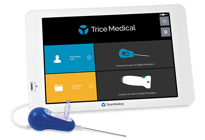 Trice Medical nabs first FDA go-ahead for disposable arthroscope with 25-degree view
