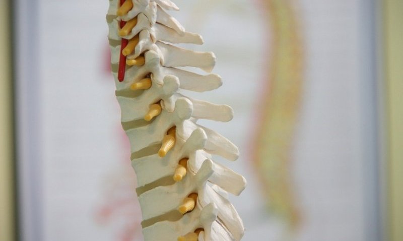 Federal investigation into spine surgeries uses mob laws to target healthcare fraud