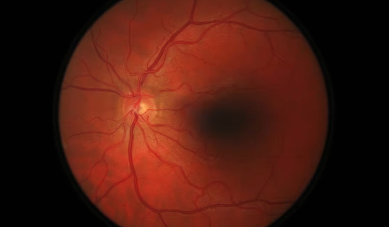 Baxter taps Digital Diagnostics’ diabetic retinopathy AI for its Welch Allyn eye scanners