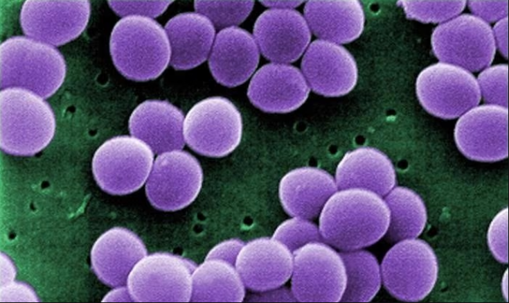 Big Pharma-backed $1B AMR Action Fund picks 1st antimicrobial biotech investments