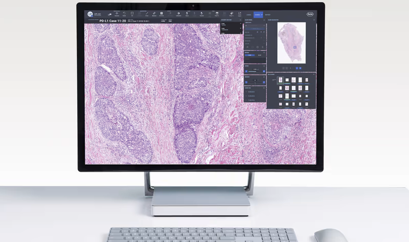 Roche, Bristol Myers partner to develop digital pathology AI to analyze clinical trial assays