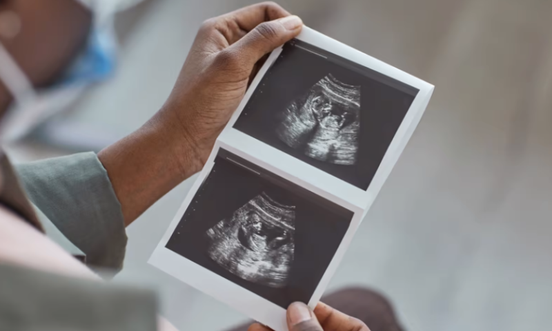 GE Healthcare aims to bring prenatal ultrasound to the home, with investment in smartphone-scanner developer