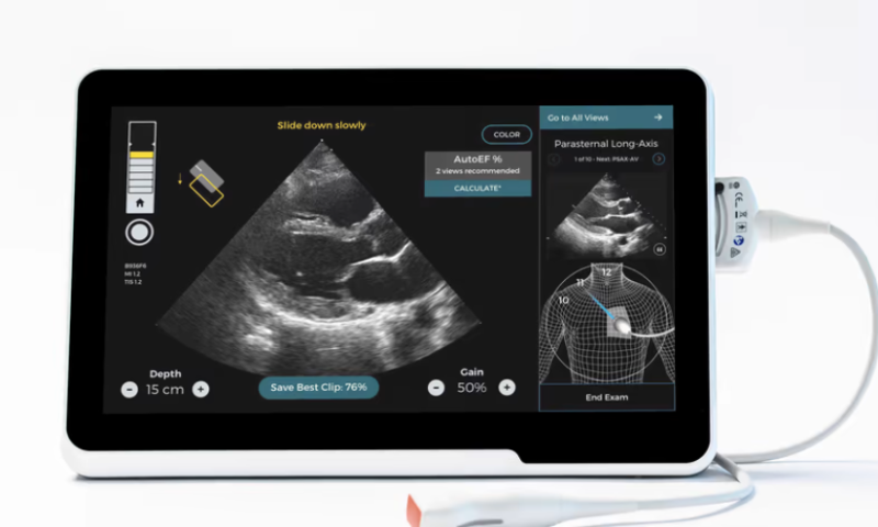 Caption Health launches AI-guided, at-home heart ultrasound service