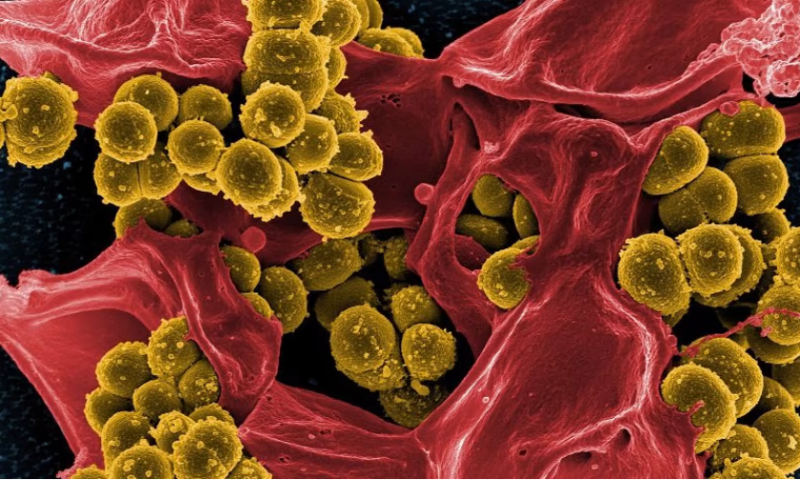 ContraFect halts phase 3 after antimicrobial fails futility test against MRSA