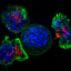 Invigorating T cells by crippling a gene to improve immunotherapies for blood and solid cancers