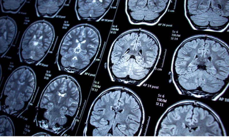 Google Cloud introduces digital suite for medical imaging