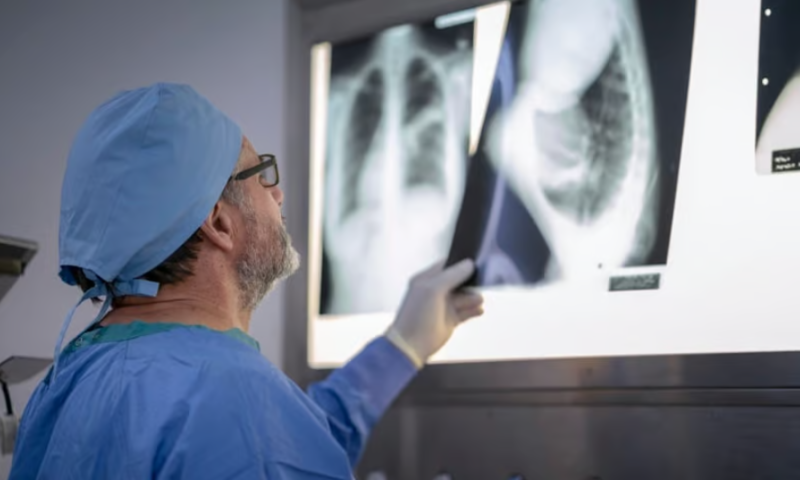 Deep learning AI could predict heart disease death from a chest X-ray 10 years out: study