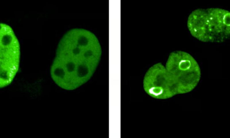 Spearing a sphere of MYC proteins could kill cancer cells