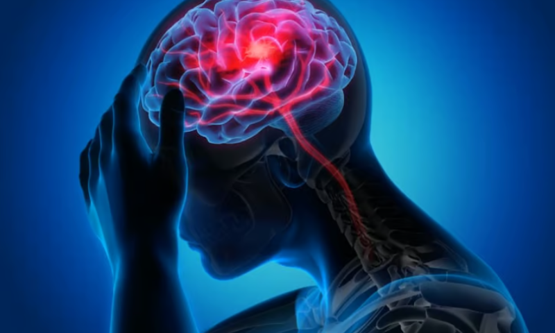Eisai rebuts NEJM report that Alzheimer’s med contributed to patient’s stroke death
