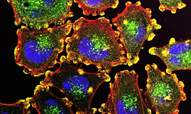 Size matters: Mechanism behind growing and shrinking cancer cells could be new treatment target