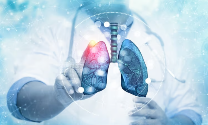 Chiesi offers Affibody breath of fresh air in respiratory disease deal worth up to $637M