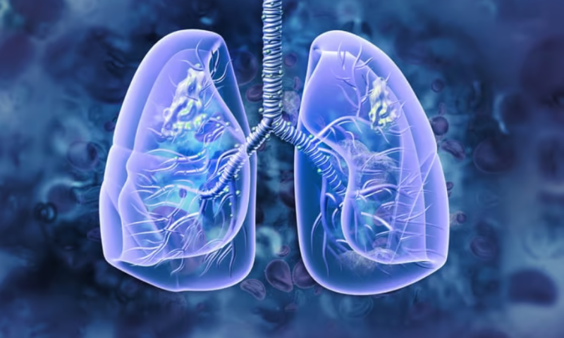 Drug resistance in non-small cell lung cancer could be curbed with CD70-targeted therapies