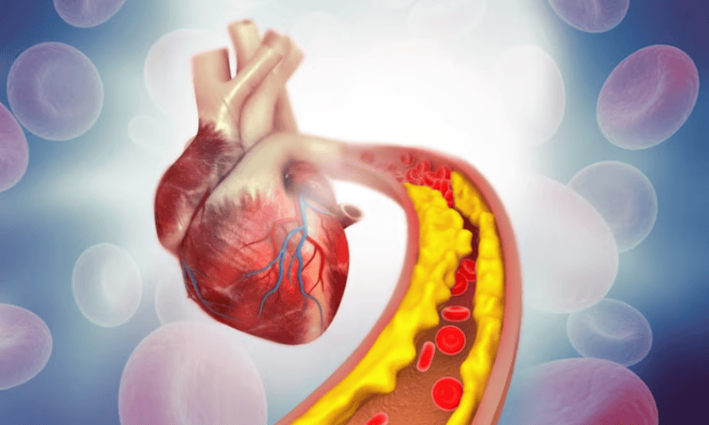 From cancer to cardiovascular disease, AstraZeneca oncology hopeful could slow atherosclerosis