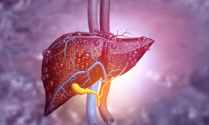 Akero’s GLP-1 combo data boost prospects of using NASH drug in patients with diabetes, obesity