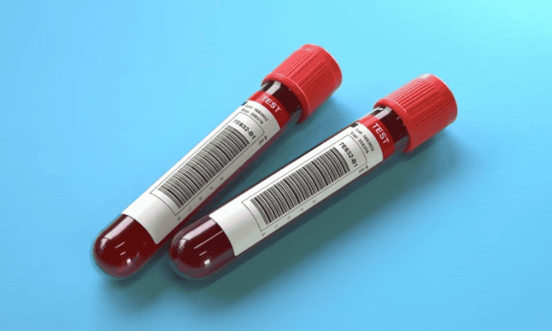 C2N Diagnostics launches revamped Alzheimer’s blood test